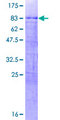 CBX6 Protein - 12.5% SDS-PAGE of human CBX6 stained with Coomassie Blue