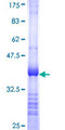 CBY1 / PGEA1 Protein - 12.5% SDS-PAGE Stained with Coomassie Blue.
