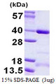 CCDC101 Protein