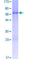 CCDC106 Protein - 12.5% SDS-PAGE of human CCDC106 stained with Coomassie Blue