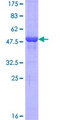 CCDC12 Protein - 12.5% SDS-PAGE of human CCDC12 stained with Coomassie Blue