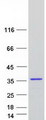 CCDC124 Protein - Purified recombinant protein CCDC124 was analyzed by SDS-PAGE gel and Coomassie Blue Staining