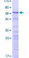 CCDC137 Protein - 12.5% SDS-PAGE of human CCDC137 stained with Coomassie Blue