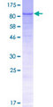 CCDC15 Protein - 12.5% SDS-PAGE of human CCDC15 stained with Coomassie Blue