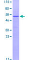 CCDC186 / C10orf118 Protein - 12.5% SDS-PAGE of human C10orf118 stained with Coomassie Blue