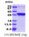 CCDC25 Protein