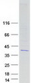 CCDC34 Protein - Purified recombinant protein CCDC34 was analyzed by SDS-PAGE gel and Coomassie Blue Staining