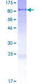 CCDC38 Protein - 12.5% SDS-PAGE of human CCDC38 stained with Coomassie Blue