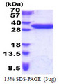 CCDC44 / TACO1 Protein