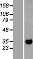 CCDC59 Protein - Western validation with an anti-DDK antibody * L: Control HEK293 lysate R: Over-expression lysate