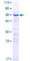 CCDC59 Protein - 12.5% SDS-PAGE of human CCDC59 stained with Coomassie Blue