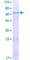 CCDC68 Protein - 12.5% SDS-PAGE of human CCDC68 stained with Coomassie Blue