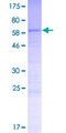CCDC74B Protein - 12.5% SDS-PAGE of human CCDC74B stained with Coomassie Blue