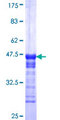 CCDC83 Protein - 12.5% SDS-PAGE Stained with Coomassie Blue.
