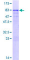 CCDC91 Protein - 12.5% SDS-PAGE of human CCDC91 stained with Coomassie Blue