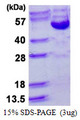 CCNB2 / Cyclin B2 Protein