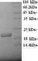 CD20 Protein - (Tris-Glycine gel) Discontinuous SDS-PAGE (reduced) with 5% enrichment gel and 15% separation gel.