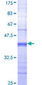 CD32A Protein - 12.5% SDS-PAGE Stained with Coomassie Blue.