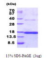 CD37 Protein