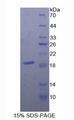 CD59 Protein - Recombinant Protectin By SDS-PAGE