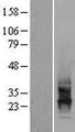 CD63 Protein - Western validation with an anti-DDK antibody * L: Control HEK293 lysate R: Over-expression lysate