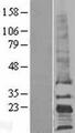 CD81 Protein - Western validation with an anti-DDK antibody * L: Control HEK293 lysate R: Over-expression lysate