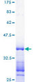 Cdc14 / CDC14A Protein - 12.5% SDS-PAGE Stained with Coomassie Blue.