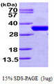 CDC34 Protein