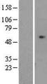 CDCA7L Protein - Western validation with an anti-DDK antibody * L: Control HEK293 lysate R: Over-expression lysate