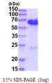 CDK5RAP3 Protein