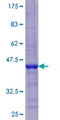 CDKAL1 Protein - 12.5% SDS-PAGE of human CDKAL1 stained with Coomassie Blue