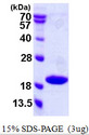 CDKN2C / p18 INK4c Protein