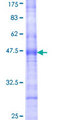 CDS1 Protein - 12.5% SDS-PAGE Stained with Coomassie Blue.