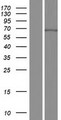 CDY2A / CDY Protein - Western validation with an anti-DDK antibody * L: Control HEK293 lysate R: Over-expression lysate