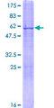CDYL Protein - 12.5% SDS-PAGE of human CDYL stained with Coomassie Blue