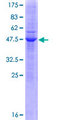CEACAM21 Protein - 12.5% SDS-PAGE of human CEACAM21 stained with Coomassie Blue