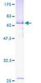 CECR5 Protein - 12.5% SDS-PAGE of human CECR5 stained with Coomassie Blue