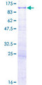 CENPC / CENP-C Protein - 12.5% SDS-PAGE of human CENPC1 stained with Coomassie Blue