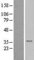 CENPP Protein - Western validation with an anti-DDK antibody * L: Control HEK293 lysate R: Over-expression lysate