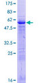 CENPP Protein - 12.5% SDS-PAGE of human CENPP stained with Coomassie Blue