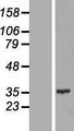 CENPQ Protein - Western validation with an anti-DDK antibody * L: Control HEK293 lysate R: Over-expression lysate