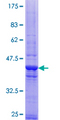CEP290 Protein - 12.5% SDS-PAGE of human Cep290 stained with Coomassie Blue