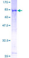 CEP55 Protein - 12.5% SDS-PAGE of human C10orf3 stained with Coomassie Blue