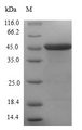 CETN1 Protein - (Tris-Glycine gel) Discontinuous SDS-PAGE (reduced) with 5% enrichment gel and 15% separation gel.