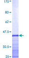 CETN3 Protein - 12.5% SDS-PAGE Stained with Coomassie Blue.