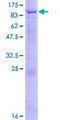 CFAP52 / WDR16 Protein - 12.5% SDS-PAGE of human WDR16 stained with Coomassie Blue