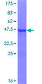 CHAC2 Protein - 12.5% SDS-PAGE of human CHAC2 stained with Coomassie Blue