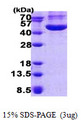 CHI3L1 / YKL-40 Protein