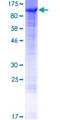 CHML Protein - 12.5% SDS-PAGE of human CHML stained with Coomassie Blue