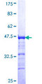 CHML Protein - 12.5% SDS-PAGE Stained with Coomassie Blue.